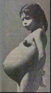 Lina, desnuda, mostrando su lado izquierdo (abril de 1939)